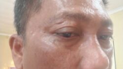 DPD PJS Sumut Desak Polisi Tangkap Pelaku Penganiayaan Wartawan di Toba