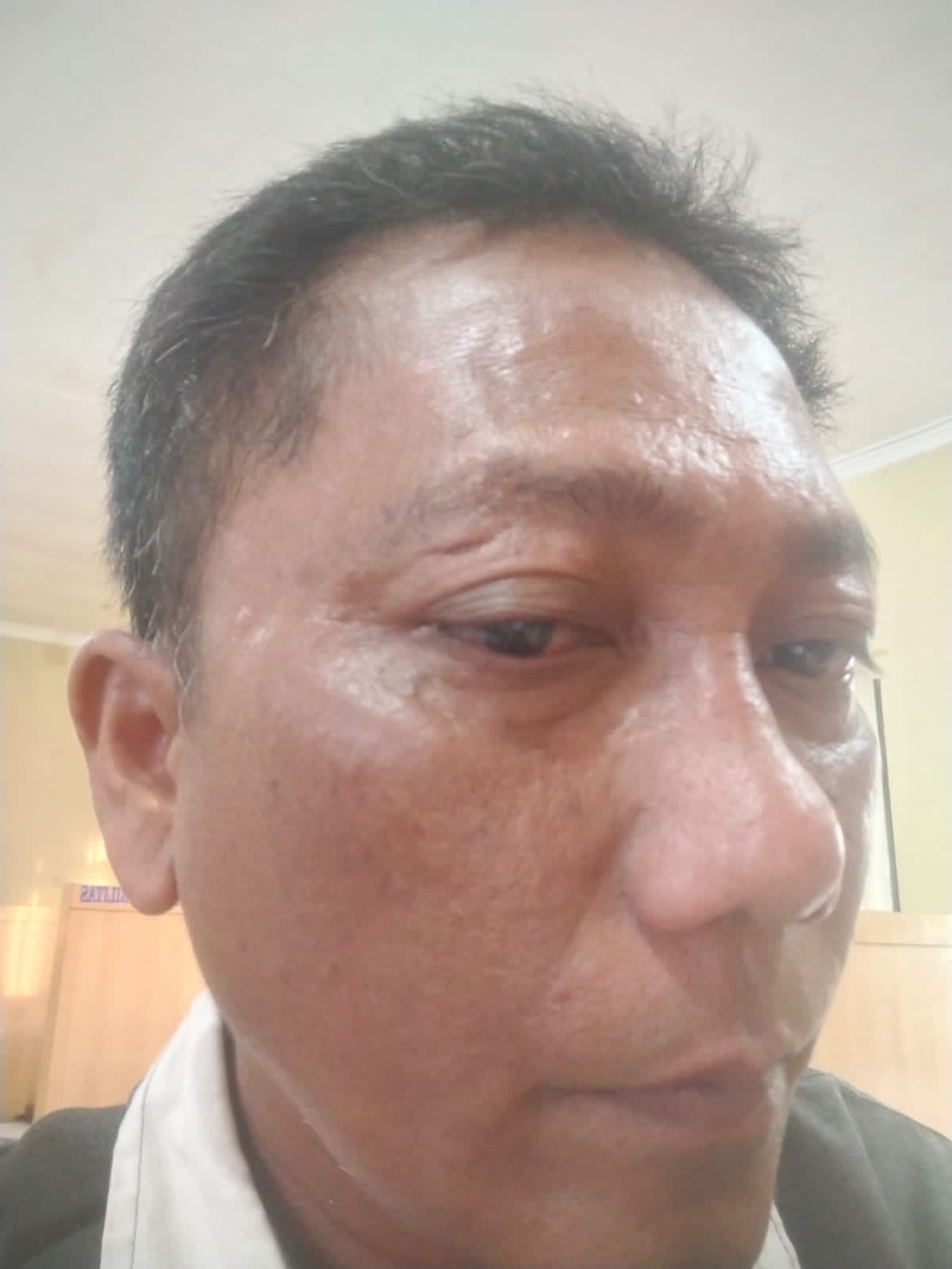 DPD PJS Sumut Desak Polisi Tangkap Pelaku Penganiayaan Wartawan di Toba