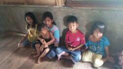 Novianti, Seorang Ibu Rumah tangga, Kesiram Air Rebusan NaSi Mendidih, Beliau Sedih Gimana Nasip 7 Anaknya Yang Masih Kecil Saya Tidak Bisa Kerja Lagi..!!?