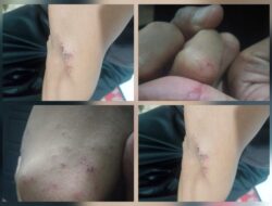 Oknum Guru Diduga Lakukan Pemukulan di Tanggamus