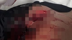 Keributan Siang Hari Berujung Penikaman, Empat Anggota Brimob Dilarikan ke Rumah Sakit