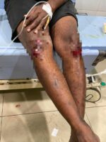 Di Pengaruhi Miras, Dua Pelaku Pengeroyokan Diamankan