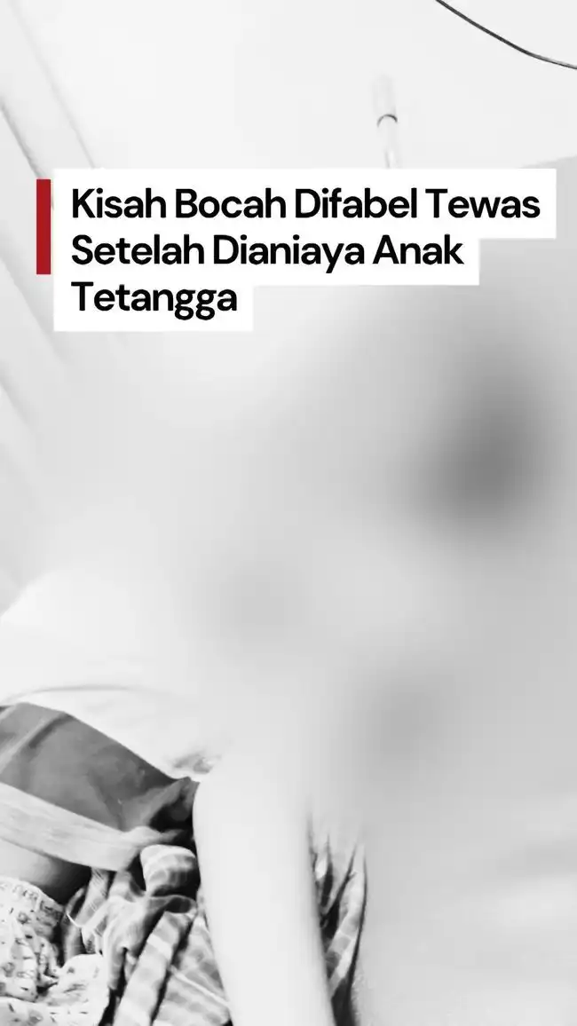 Anak Berkebutuhan Khusus di Surabaya Meninggal Setelah Ditemukan Terjerat Tali